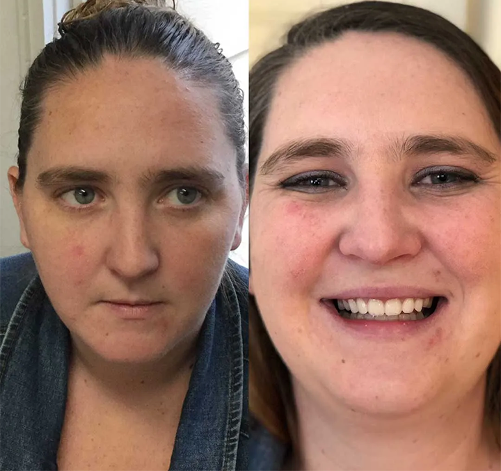 Allday Secure Kunstgebitlijm