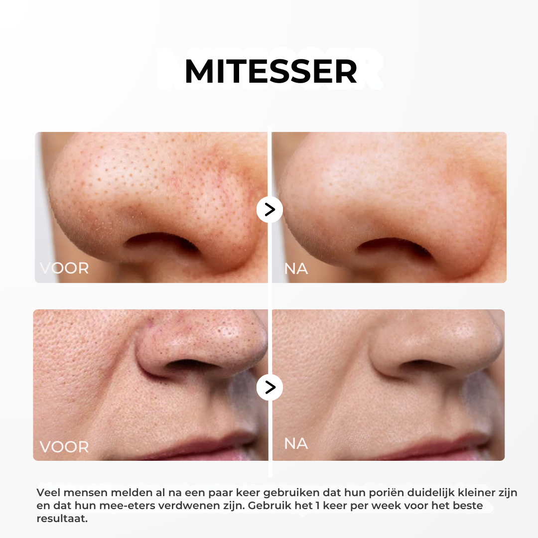 Rice Peel Glow Serum