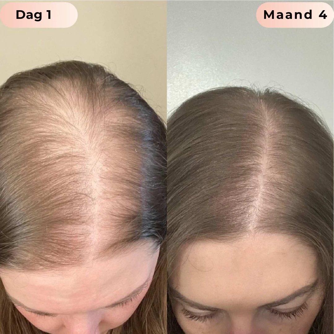 Haar Serum Roller