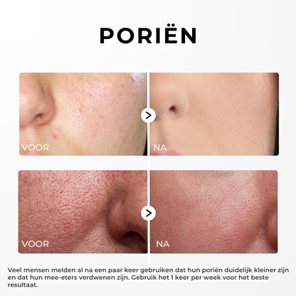 Rice Peel Glow Serum