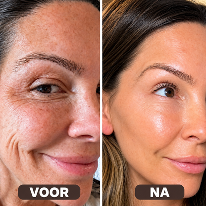 Collagen Volume Balm – Voor rimpels en een verslapte huid