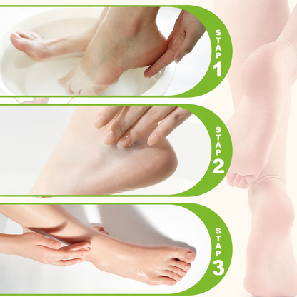 Hydraterende en Anti-Kloven Voetcrème
