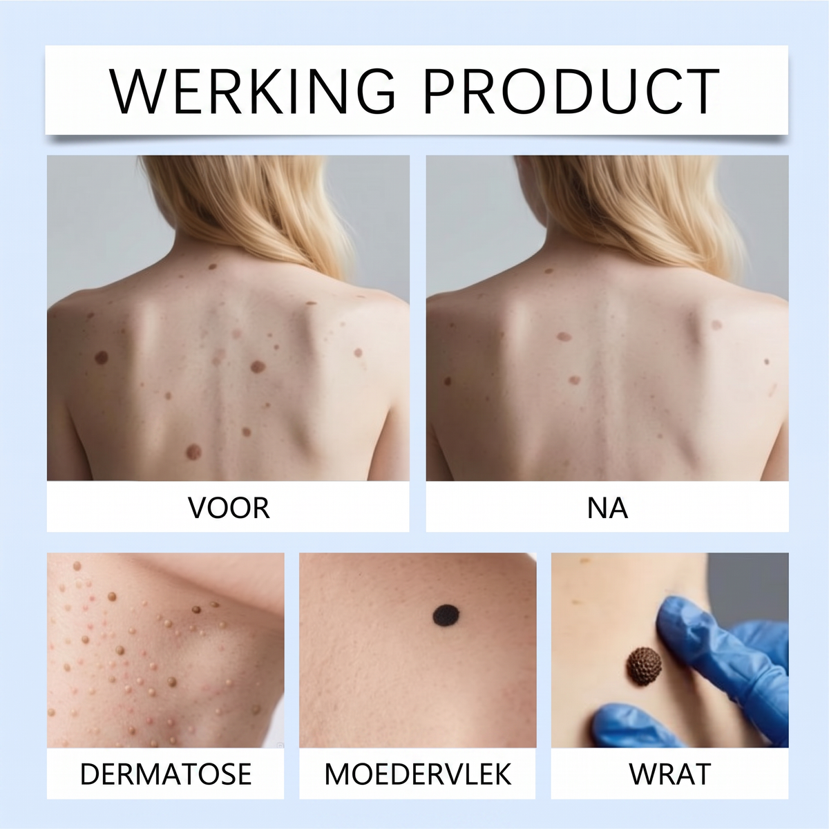 ClearRoller™ Roller Serum - Geavanceerd Een Heldere Huid