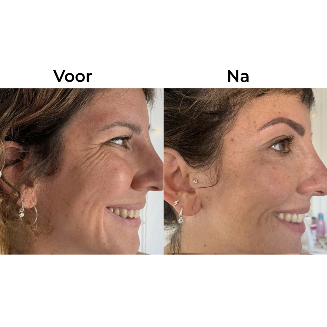 Siliconen Beautystrip