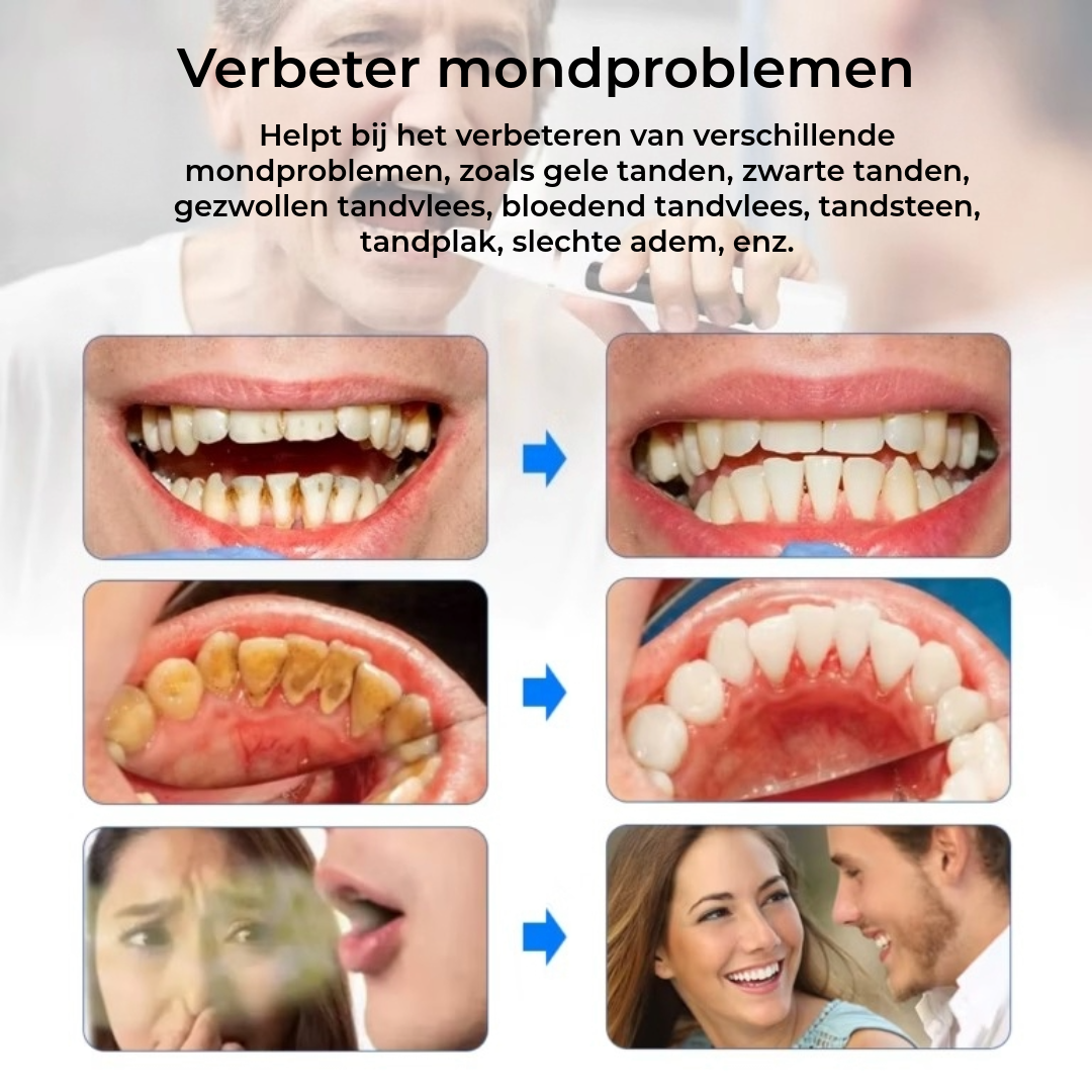GlowSmile – Ultrasone reiniging voor een zichtbaar frissere glimlach