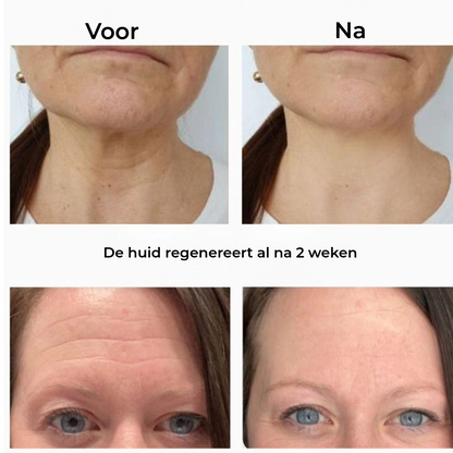 Siliconen Beautystrip