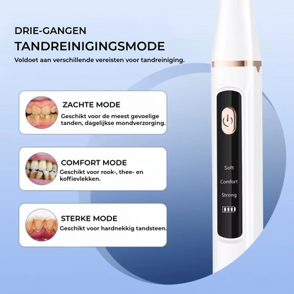 GlowSmile – Ultrasone reiniging voor een zichtbaar frissere glimlach