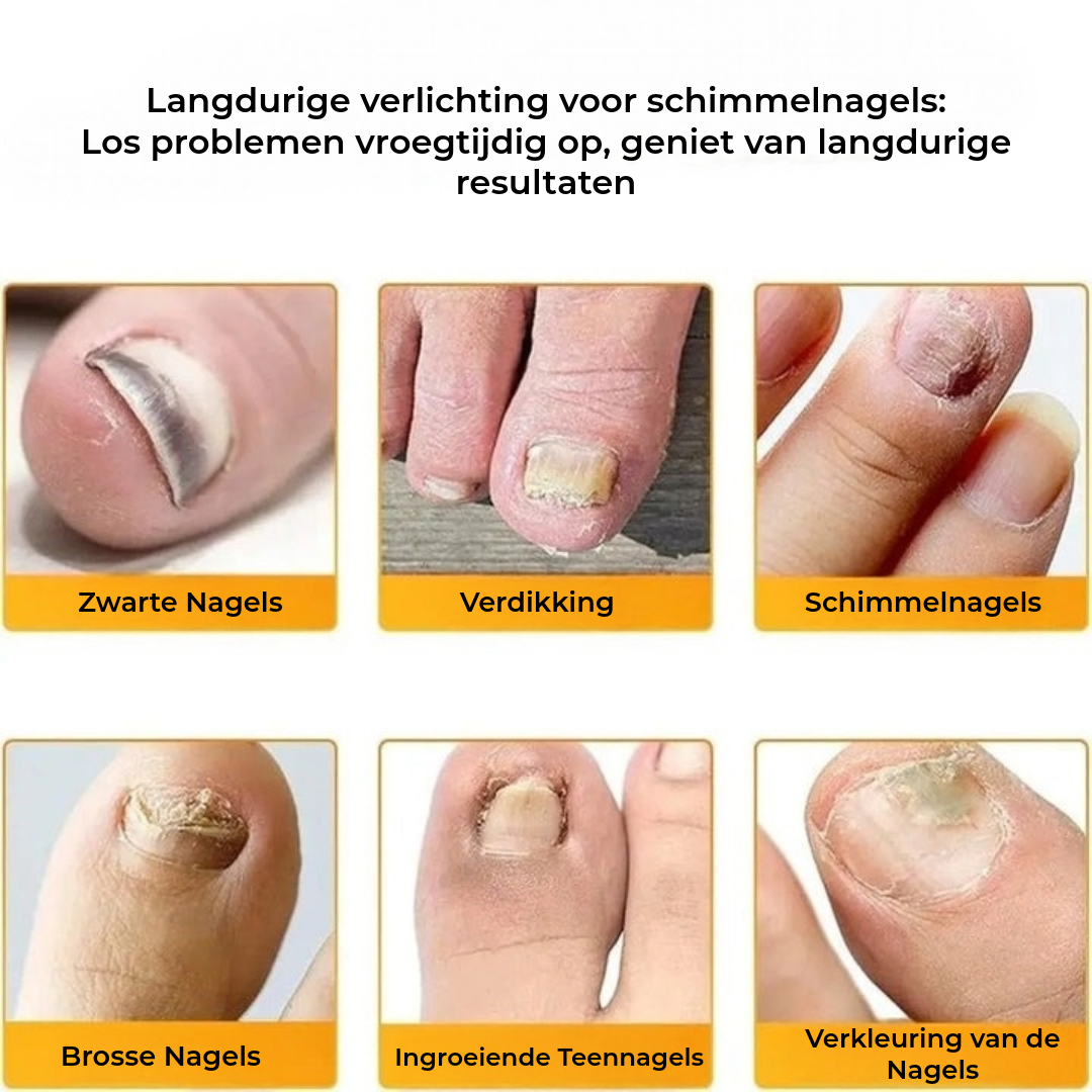 FungalPatch - Antibacterieel Schimmelwerend Patch En Nagelverzorging Pak