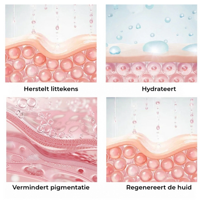 Siliconen Beautystrip