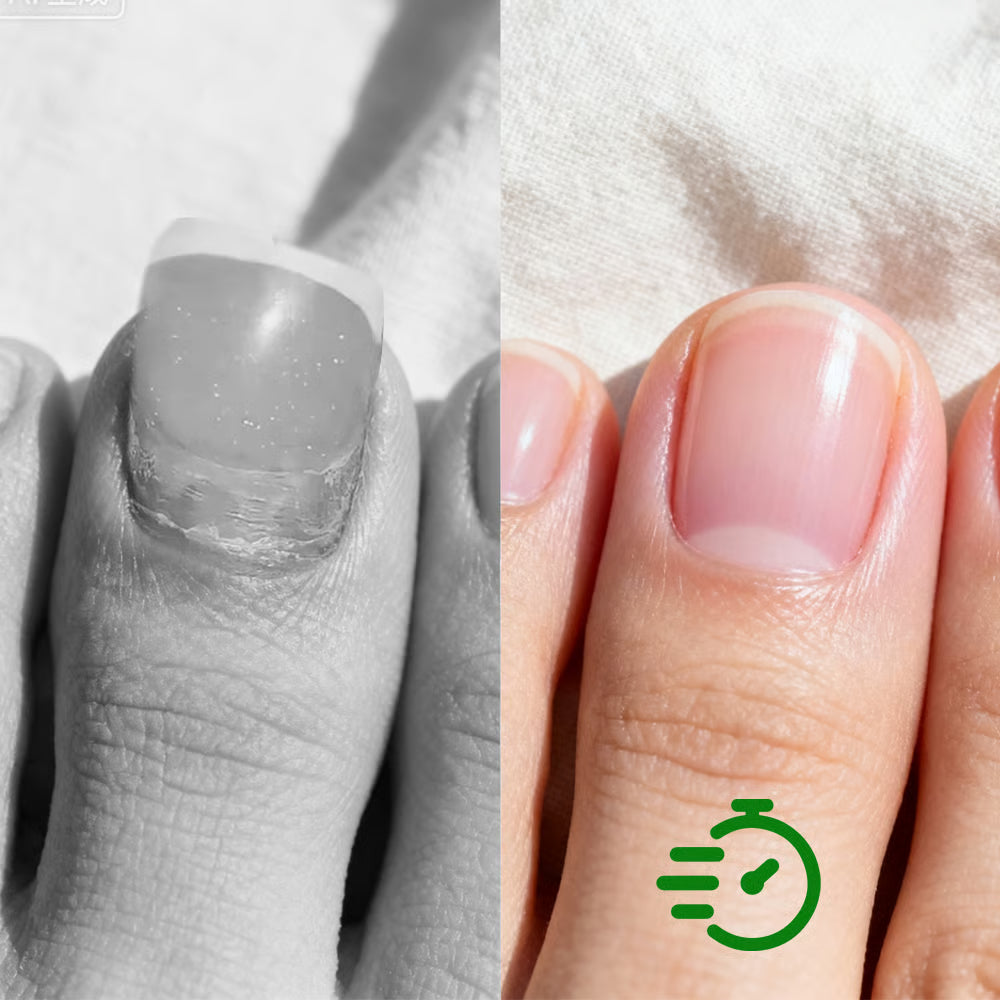Anti-schimmel Nagelherstellende Oplossing