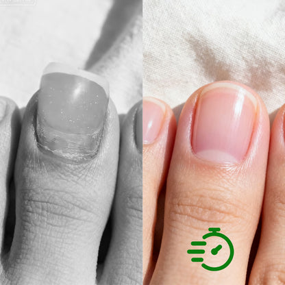 Anti-schimmel Nagelherstellende Oplossing